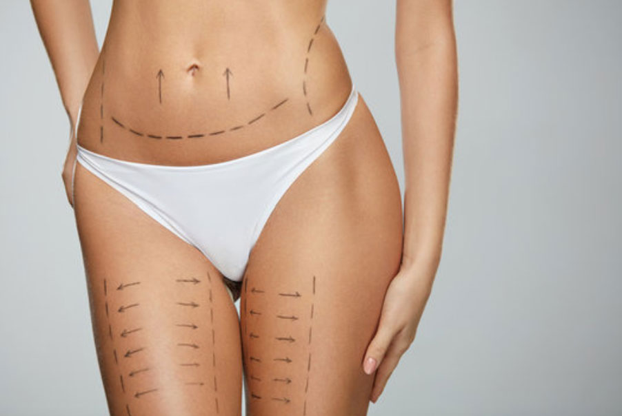 <CENTER>Chirurgie de la silhouette</center>